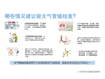 支气管镜科普知识